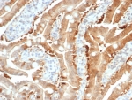 IHC staining of FFPE human small intestine tissue with Estrogen Sulfotransferase antibody (clone SULT1E1/7124). HIER: boil tissue sections in pH 9 10mM Tris with 1mM EDTA for 20 min and allow to cool before testing.
