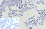 IHC staining of FFPE human lung tissue with NKX2.1 antibody (clone TTF1/8123R). Inset: PBS used in place of primary Ab (secondary Ab negative control). HIER: boil tissue sections in pH 9 10mM Tris with 1mM EDTA for 20 min and allow to cool before testing.