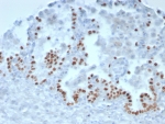 IHC staining of FFPE human lung tissue with NKX2.1 antibody (clone TTF1/8143R). HIER: boil tissue sections in pH 9 10mM Tris with 1mM EDTA for 20 min and allow to cool before testing.