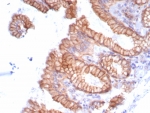 IHC staining of FFPE human stomach tissue with Migfilin-1 antibody (clone FBLIM1/8189R). HIER: boil tissue sections in pH 9 10mM Tris with 1mM EDTA for 20 min and allow to cool before testing.