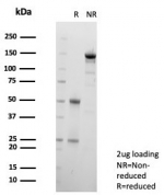 SDS-PAGE analysis of purified, BSA-free Galectin-3 antibody (clone LGALS3/6583) as confirmation of integrity and purity.