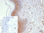 IHC staining of FFPE human skin tissue with Galectin-3 antibody (clone LGALS3/6583). Inset: PBS used in place of primary Ab (secondary Ab negative control). HIER: boil tissue sections in pH 9 10mM Tris with 1mM EDTA for 20 min and allow to cool before testing.