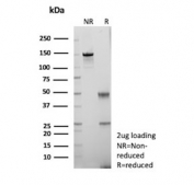 SDS-PAGE analysis of purified, BSA-free recombinant LGALS3 antibody (clone rLGALS3/7286) as confirmation of integrity and purity.