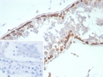 IHC staining of FFPE human testis tissue with HIF1 alpha antibody (clone HIF1A/8795). Inset: PBS used in place of primary Ab (secondary Ab negative control). HIER: boil tissue sections in pH 9 10mM Tris with 1mM EDTA for 20 min and allow to cool before testing.