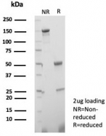 SDS-PAGE analysis of purified, BSA-free TGF beta 3 antibody (clone TGFB3/4801) as confirmation of integrity and purity.