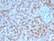 IHC staining of FFPE human liver in colon with SERPINA1 antibody (AAT/6323). HIER: boil tissue sections in pH 9 10mM Tris with 1mM EDTA for 20 min and allow to cool before testing.