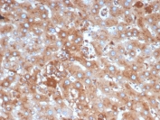 IHC staining of FFPE human liver in colon with SERPINA1 antibody(AAT/6325). HIER: boil tissue sections in pH 9 10mM Tris with 1mM EDTA for 20 min and allow to cool before testing.
