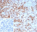 IHC staining of FFPE human tonsil tissue with SERPINA1 antibody (clone AAT/6325). Inset: PBS used in place of primary Ab (secondary Ab negative control). HIER: boil tissue sections in pH 9 10mM Tris with 1mM EDTA for 20 min and allow to cool before testing.