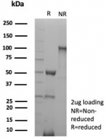 SDS-PAGE analysis of purified, BSA-free recombinant CKB antibody (clone rCKBB/8839) as confirmation of integrity and purity.