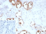 IHC staining of FFPE human kidney tissue with recombinant CKB antibody (clone rCKBB/8839). Inset: PBS used in place of primary Ab (secondary Ab negative control). HIER: boil tissue sections in pH 9 10mM Tris with 1mM EDTA for 20 min and allow to cool before testing.