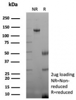 SDS-PAGE analysis of purified, BSA-free recombinant CKBB antibody (clone rCKBB/8844) as confirmation of integrity and purity.