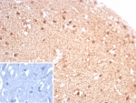 IHC staining of FFPE human brain tissue with recombinant CKBB antibody (clone rCKBB/8844). Inset: PBS used in place of primary Ab (secondary Ab negative control). HIER: boil tissue sections in pH 9 10mM Tris with 1mM EDTA for 20 min and allow to cool before testing.
