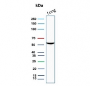 Western blot testing of human lung tissue lysate with Alpha-1-Antitrypsin antibody. Expected molecular weight: 47-52 kDa depending on the level of glycosylation.