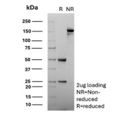 SDS-PAGE analysis of purified, BSA-free Alpha-1-Antitrypsin antibody (clone AAT/4609) as confirmation of integrity and purity.