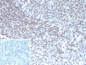 IHC staining of FFPE human tonsil tissue with YY1 antibody (YY1/5436). Inset: PBS used in place of primary Ab (secondary Ab negative control). HIER: boil tissue sections in pH 9 10mM Tris with 1mM EDTA for 20 min and allow to cool before testing.