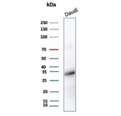 Western blot testing of human Daudi cell lysate with YY1 Mouse Monoclonal (YY1/5436). Predicted molecular weight ~45 kDa but commonly observed at 45~65 kDa.