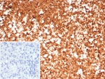 IHC staining of FFPE human spleen tissue with HSP90AA1 antibody (clone HSP90AA1/7426). Inset: PBS used in place of primary Ab (secondary Ab negative control). HIER: boil tissue sections in pH 9 10mM Tris with 1mM EDTA for 20 min and allow to cool before testing.