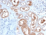 IHC staining of FFPE human kidney tissue with HSP90 alpha antibody (clone HSP90AA1/7247). Inset: PBS used in place of primary Ab (secondary Ab negative control). HIER: boil tissue sections in pH 9 10mM Tris with 1mM EDTA for 20 min and allow to cool before testing.