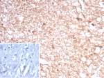 IHC staining of FFPE human brain tissue with recombinant Creatine kinase B antibody (clone rCKBB/8841). Inset: PBS used in place of primary Ab (secondary Ab negative control). HIER: boil tissue sections in pH 9 10mM Tris with 1mM EDTA for 20 min and allow to cool before testing.
