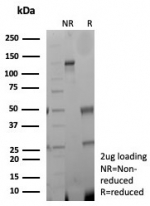 SDS-PAGE analysis of purified, BSA-free recombinant CKBB antibody (clone rCKBB/8842) as confirmation of integrity and purity.