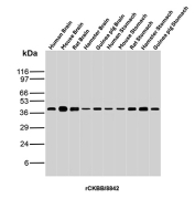CKBB Antibody Multi-Species Brain WB. Western blot analysis of Human Brain, Mouse Brain, Rat Brain, Hamster Brain, Guinea pig Brain, Human Stomach, Mouse Stomach, Rat Stomach, Hamster Stomach and Guinea pig Stomach tissue lysates using CKBB antibody (clone rCKBB/8842). Predicted molecular weight ~43 kDa.