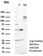 SDS-PAGE analysis of purified, BSA-free recombinant Brain Creatine Kinase antibody (clone CKBB/8310R) as confirmation of integrity and purity.