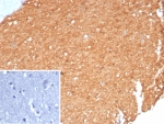 IHC staining of FFPE human brain tissue with recombinant Brain Creatine Kinase antibody (clone CKBB/8310R). Inset: PBS used in place of primary Ab (secondary Ab negative control). HIER: boil tissue sections in pH 9 10mM Tris with 1mM EDTA for 20 min and allow to cool before testing.