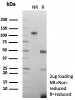 SDS-PAGE analysis of purified, BSA-free Creatine kinase B antibody (clone CKBB/8608R) as confirmation of integrity and purity.
