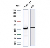 Western blot testing of human HEK293 and Y79 cell lysate with Brain Creatine Kinase antibody (clone CKBB/8843R). Predicted molecular weight ~43 kDa.