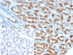 IHC staining of FFPE human stomach tissue with Thrombospondin-1 antibody (clone THBS1/4532). Inset: PBS used in place of primary Ab (secondary Ab negative control). HIER: boil tissue sections in pH 9 10mM Tris with 1mM EDTA for 20 min and allow to cool before testing.