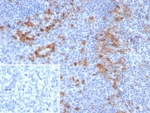 IHC staining of FFPE human tonsil tissue with B7-H3 antibody (clone B7H3/4479) at 2ug/ml. Inset: PBS used in place of primary Ab (secondary Ab negative control). HIER: boil tissue sections in pH 9 10mM Tris with 1mM EDTA for 20 min and allow to cool before testing.