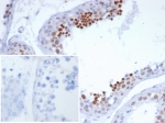 IHC staining of FFPE human testis tissue with NUTM1 antibody (clone SNUPN/7351R). Inset: PBS used in place of primary Ab (secondary Ab negative control). HIER: boil tissue sections in pH 9 10mM Tris with 1mM EDTA for 20 min and allow to cool before testing.