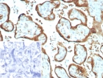 IHC staining of FFPE human placental tissue with IMP3 antibody (clone IMP3/8934R) Inset: PBS used in place of primary Ab (secondary Ab negative control). HIER: boil tissue sections in pH 9 10mM Tris with 1mM EDTA for 20 min and allow to cool before testing.