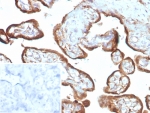 IHC staining of FFPE human placental tissue with recombinant IMP3 antibody (clone IMP3/8985R) Inset: PBS used in place of primary Ab (secondary Ab negative control). HIER: boil tissue sections in pH 9 10mM Tris with 1mM EDTA for 20 min and allow to cool before testing.