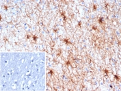 IHC staining of FFPE human brain tissue with TrkC antibody (clone NTRK3/7140). Inset: PBS used in place of primary Ab (secondary Ab negative control). HIER: boil tissue sections in pH 9 10mM Tris with 1mM EDTA for 20 min and allow to cool before testing.