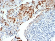 IHC staining of FFPE human tonsil with TrkC antibody (clone NTRK3/7140). HIER: boil tissue sections in pH 9 10mM Tris with 1mM EDTA for 20 min and allow to cool before testing.