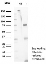 SDS-PAGE analysis of purified, BSA-free CD11b antibody (clone ITGAM/4741) as confirmation of integrity and purity.