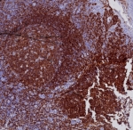 IHC staining of FFPE human tonsil tissue with CD19 antibody (clone CD19/7665). HIER: boil tissue sections in pH 9 10mM Tris with 1mM EDTA for 20 min and allow to cool before testing.