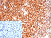 IHC staining of FFPE human tonsil tissue with CD19 antibody (clone CD19/7665). HIER: boil tissue sections in pH 9 10mM Tris with 1mM EDTA for 20 min and allow to cool before testing.