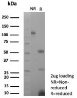 SDS-PAGE analysis of purified, BSA-free recombinant Estrogen Inducible Protein pS2 antibody (clone TFF1/8817R) as confirmation of integrity and purity.