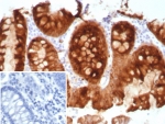 IHC staining of FFPE human colon tissue with recombinant Estrogen Inducible Protein pS2 antibody (clone TFF1/8817R). Inset: PBS used in place of primary Ab (secondary Ab negative control). HIER: boil tissue sections in pH 9 10mM Tris with 1mM EDTA for 20 min and allow to cool before testing.