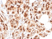 IHC staining of FFPE human pancreas tissue with Glycoprotein 2 antibody (clone GP2/3510). HIER: boil tissue sections in pH 9 10mM Tris with 1mM EDTA for 20 min and allow to cool before testing.