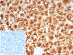 IHC staining of FFPE human pancreas tissue with recombinant GP2 antibody (clone rGP2/8617). Inset: PBS used in place of primary Ab (secondary Ab negative control). HIER: boil tissue sections in pH 9 10mM Tris with 1mM EDTA for 20 min and allow to cool before testing.