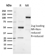 SDS-PAGE analysis of purified, BSA-free Glycoprotein 2 antibody (clone GP2/3133R) as confirmation of integrity and purity.