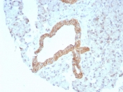 IHC staining of FFPE human prostate tissue with recombinant CD269 antibody (clone rCD269/8507). HIER: boil tissue sections in pH 9 10mM Tris with 1mM EDTA for 20 min and allow to cool before testing.