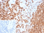 IHC staining of FFPE human spleen tissue with Polo like kinase 1 antibody (clone PLK1/7122). Inset: PBS used in place of primary Ab (secondary Ab negative control). HIER: boil tissue sections in pH 9 10mM Tris with 1mM EDTA for 20 min and allow to cool before testing.