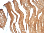 IHC staining of FFPE human smooth muscle tissue with SMMHC antibody (clone MYH11/7610R). HIER: boil tissue sections in pH 9 10mM Tris with 1mM EDTA for 20 min and allow to cool before testing.