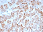 IHC staining of FFPE human smooth muscle tissue with SMMHC antibody (clone MYH11/8185R). HIER: boil tissue sections in pH 9 10mM Tris with 1mM EDTA for 20 min and allow to cool before testing.