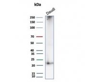 Western blot testing of human Daudi cell lysate with CD269 antibody (clone BCMA/7254). Expected molecular weight: 20-27 kDa depending on glycosylation level.