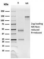 SDS-PAGE analysis of purified, BSA-free SM-MHC antibody (clone SM-M10) as confirmation of integrity and purity.
